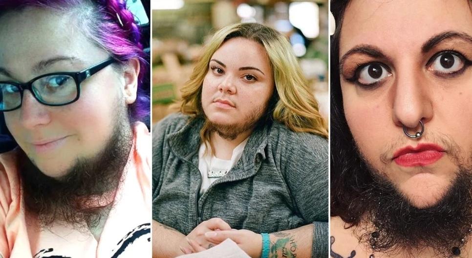 意大利女子牙龈长出睫毛状毛发，历经8年未治愈，病因很常见