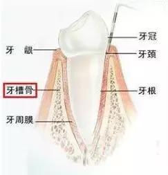 拔完牙窟窿里有食物残渣,拔完牙的窟窿进食物了怎么办