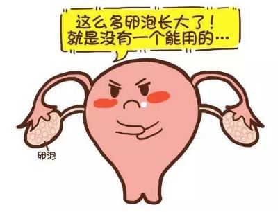 聊聊多囊卵巢综合征的那些事,聊聊不一样的多囊卵巢综合征