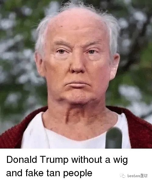 为什么老特的眼袋是白色的？