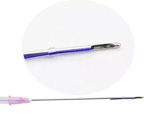 科普线雕会有哪些后遗症,线雕解密