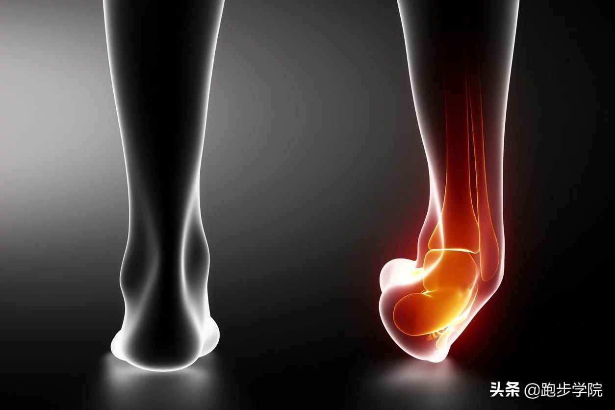 脚踝扭伤的药有哪些,脚踝扭伤了需要吃点什么