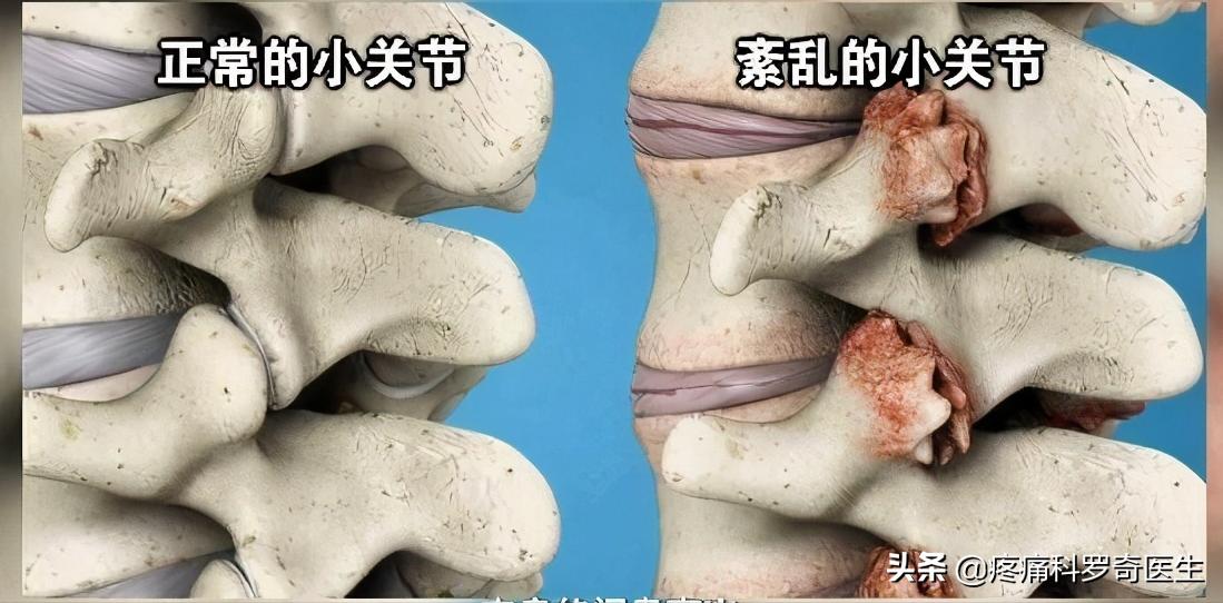 你的腰痛是怎么回事,你的腰痛是哪种