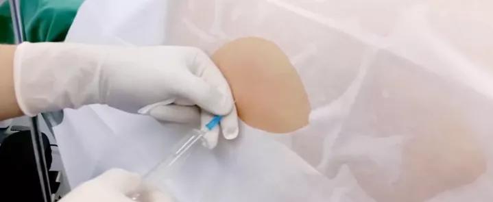 关于无痛分娩的真相孕妈要知道,带你揭秘无痛分娩的真相