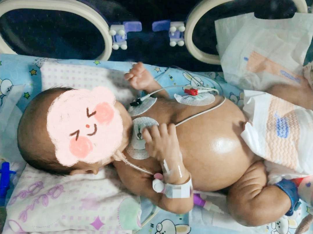 早产宝宝消化不好吃啥好,早产宝宝肠胃不好不长肉