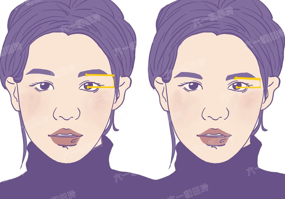 额头细纹皱纹怎么区别,额头上的细纹怎么解决