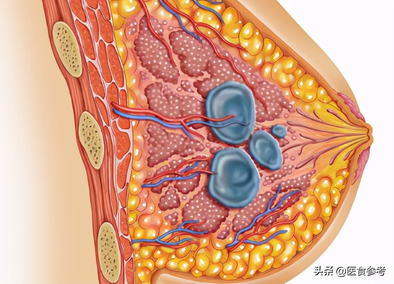 身体出现什么症状要警惕妇科疾病,妇科肿瘤的症状10大前兆