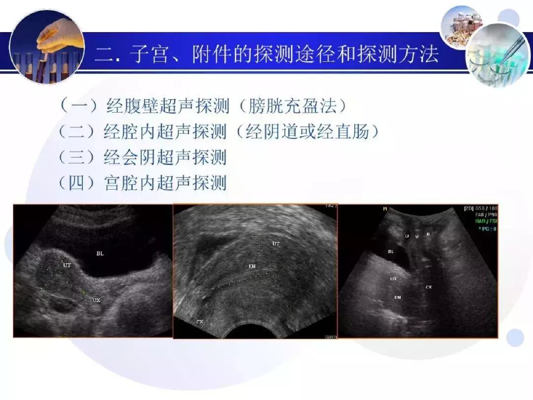 纯干货！子宫及附件解剖和超声诊断