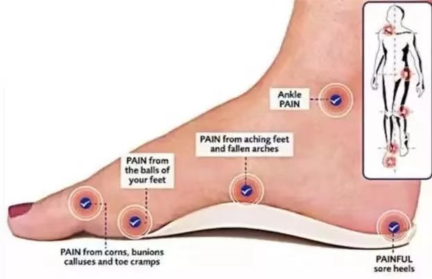扁平足拇指外翻的治疗方法,全国治疗扁平足前十的医院