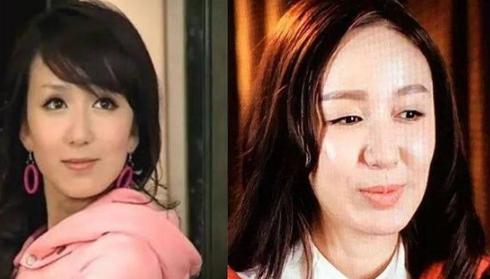 中庭过宽怎么办,中庭过长显老气