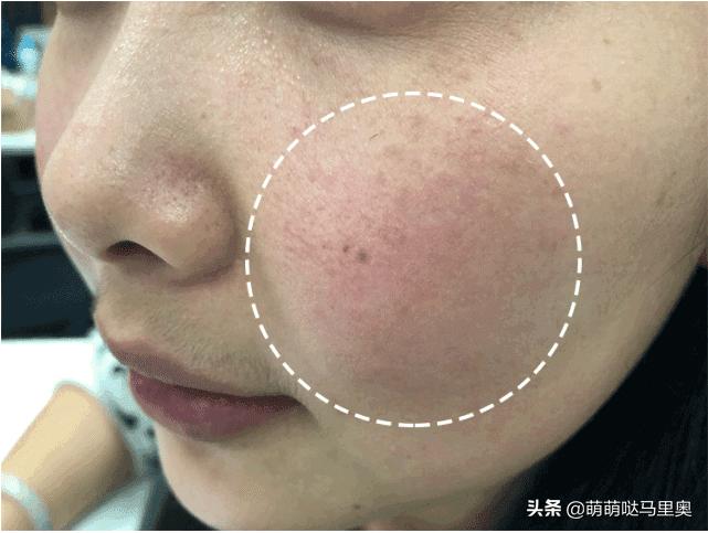 械字号的面膜护肤品有哪些,械字号面膜和普通面膜