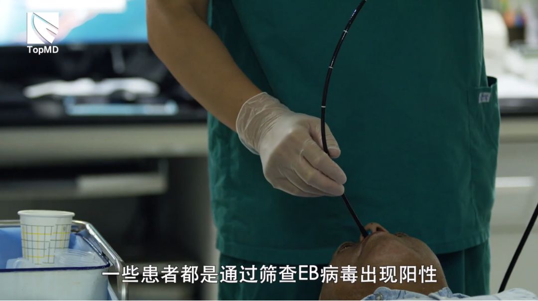 体检出eb病毒能治愈吗,体检报告eb病毒