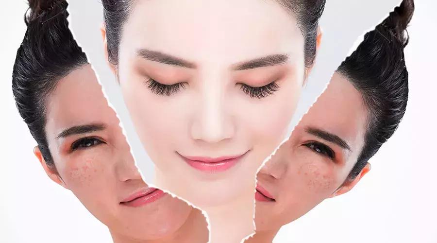 花了上万块祛斑有反弹的吗,激光祛斑反黑用什么产品能恢复好