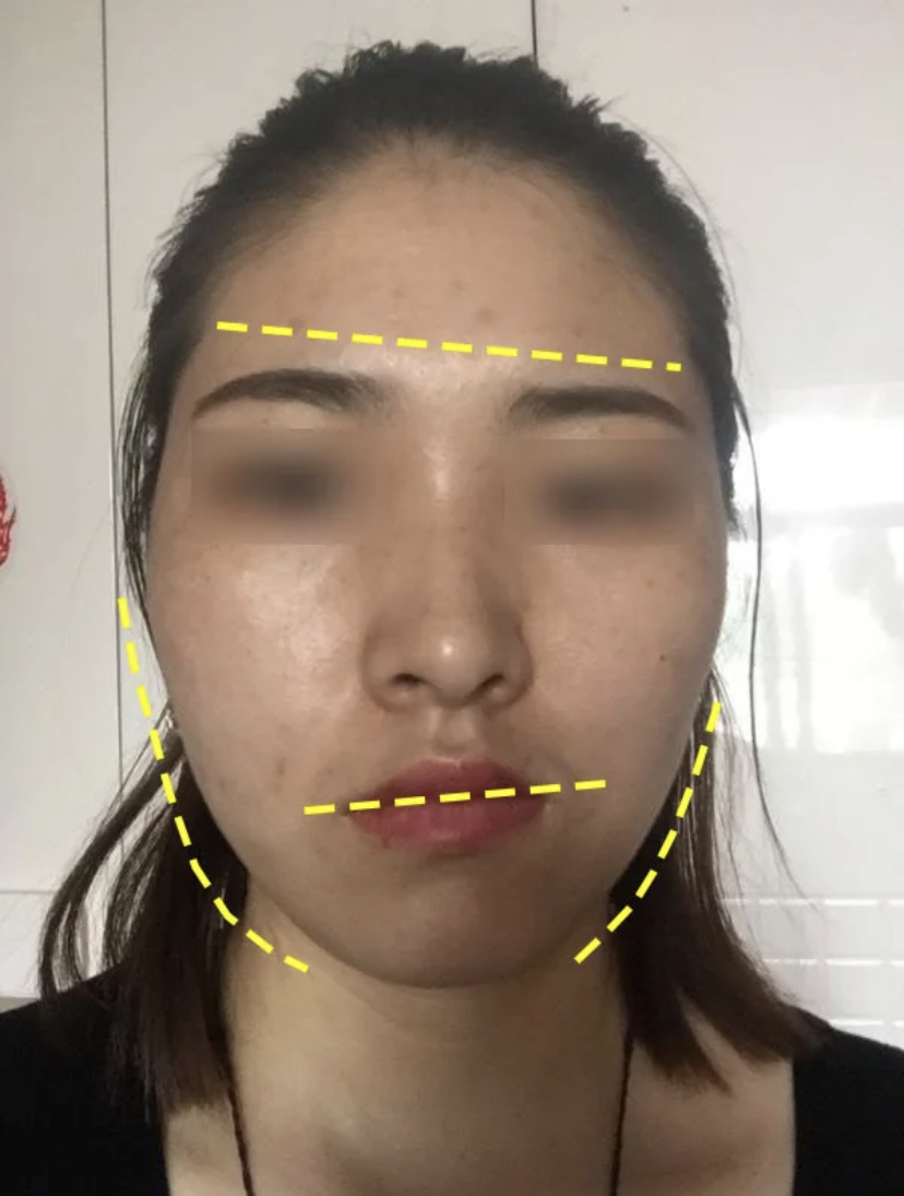 大小脸改善大方脸,大小脸是改善大脸还是改善小脸