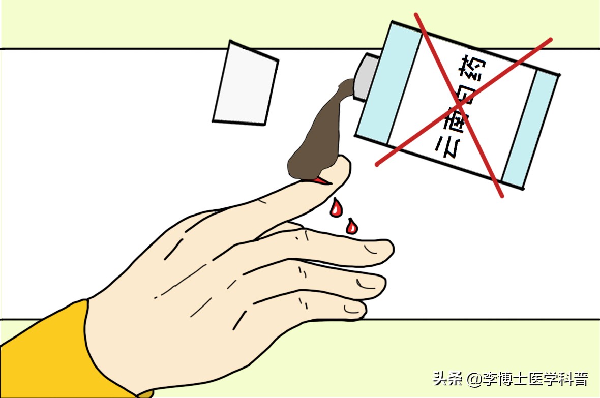手外伤撕裂恢复最佳方法,手外伤的急救处理与断指的保存