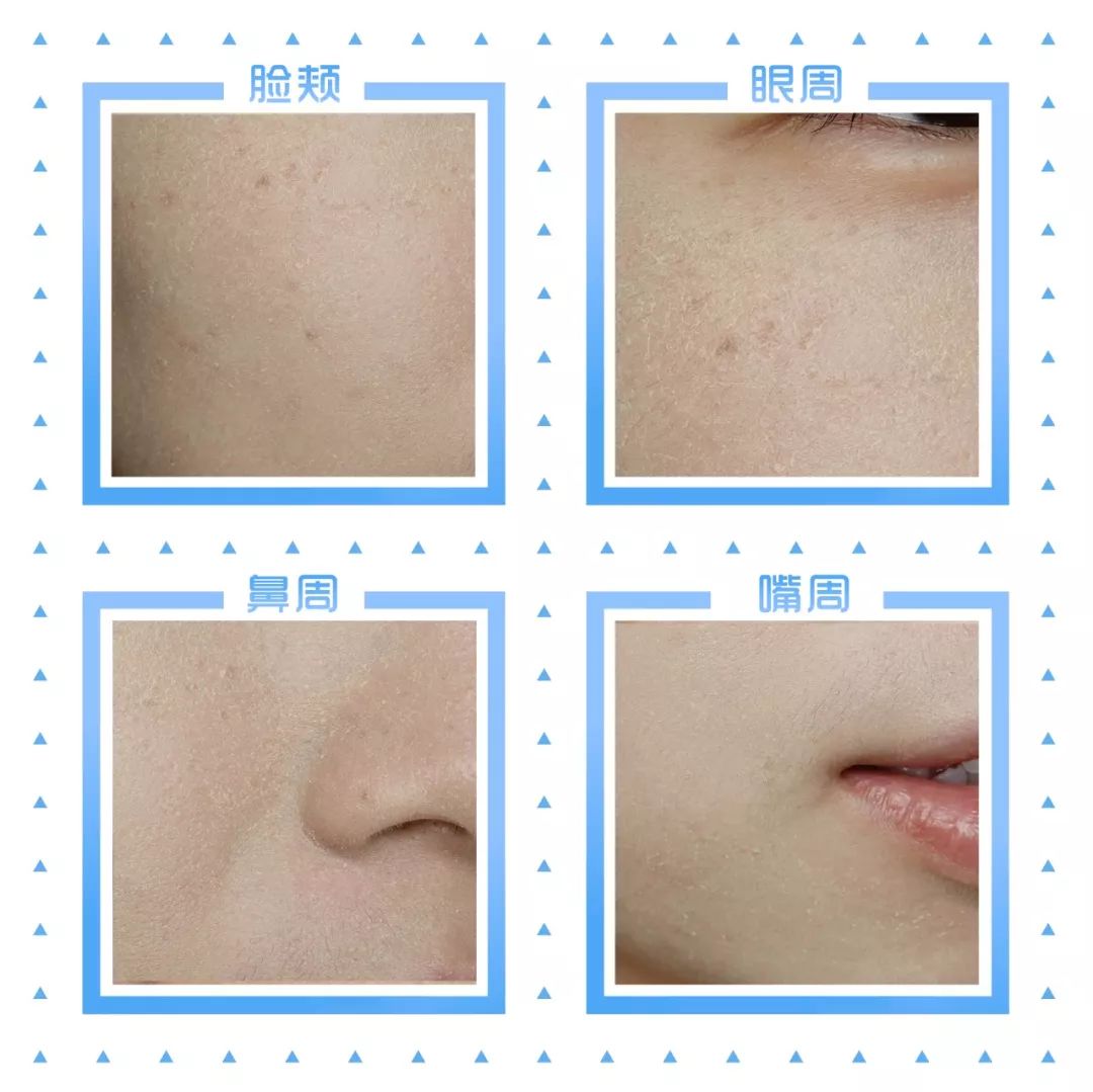 「Foundation101」遮瑕组在线battle!谁才是水煮蛋之王？（上）