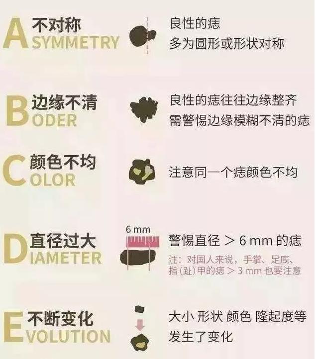 怎么判断黑色素痣还是色素痣,色素痣是否会恶变为恶性黑色素瘤