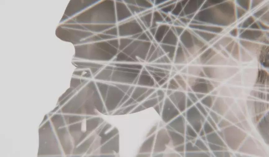 资生堂抗皱小雷达是哪个系列,资生堂的抗皱雷达好用吗