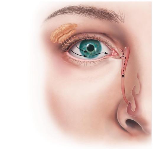 新生儿单侧眼屎多流眼泪,新生儿眼屎多怎么办