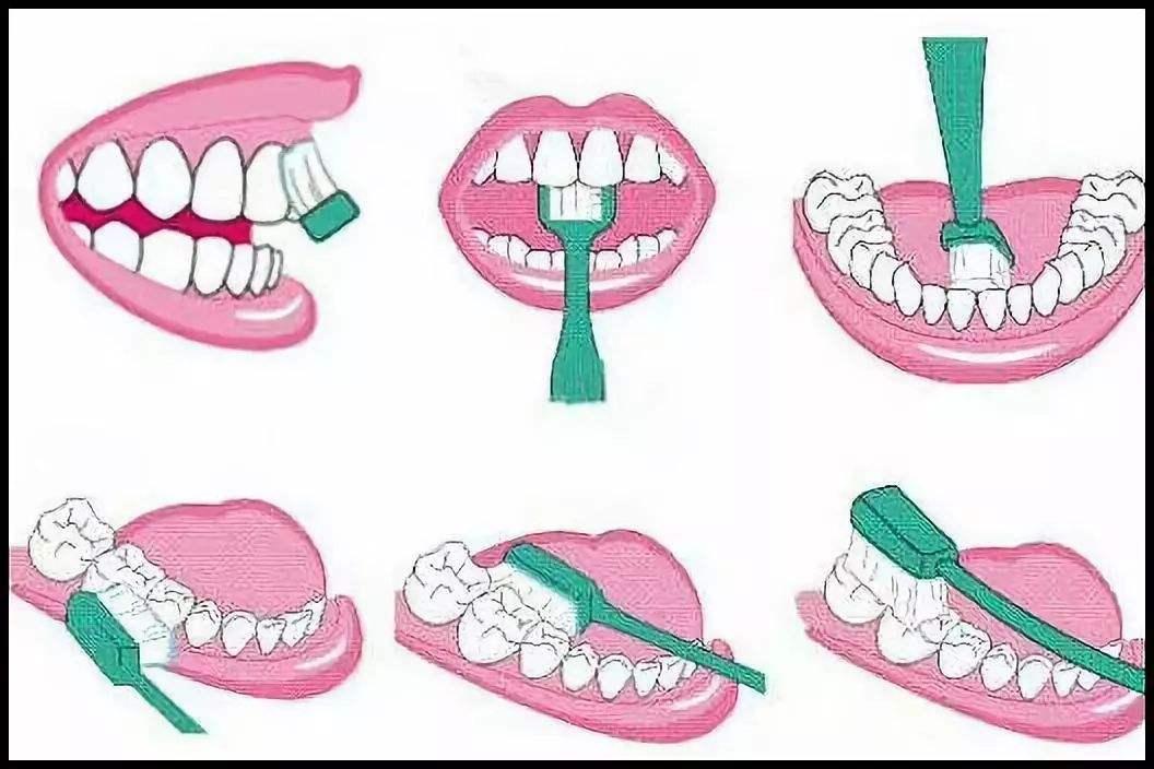 如何挑选适合自己的电动牙刷,如何挑选正确的电动牙刷