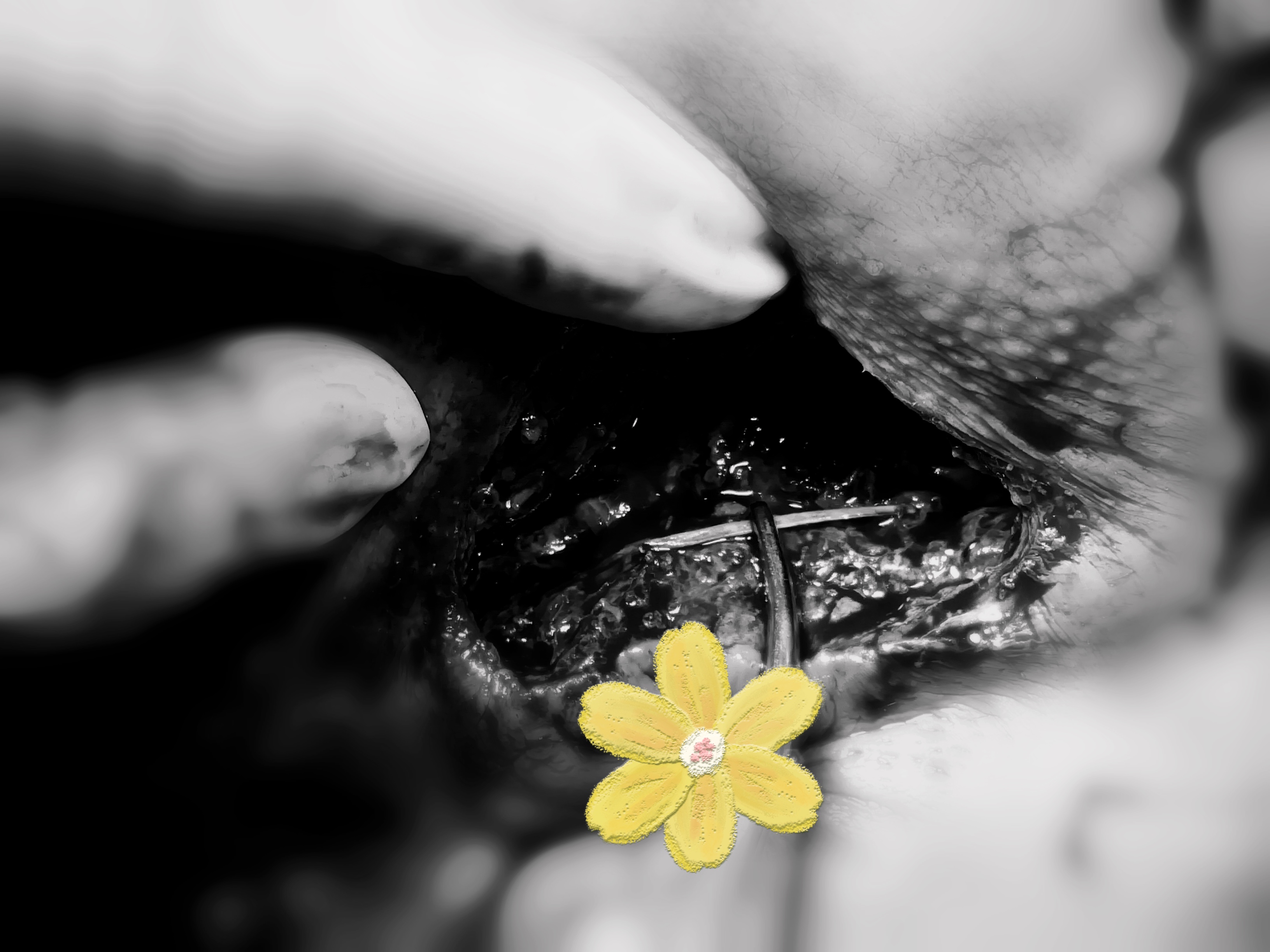 屁屁痛是什么原因,屁屁痛是上火吗