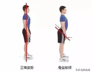 总是磨鞋底怎么办,总是磨鞋底是什么原因