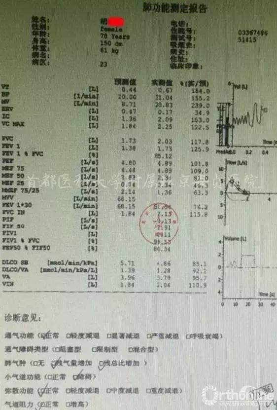 颈椎病引起的胸闷胸痛在哪个部位,颈椎病会引起咳嗽胸闷胸痛吗