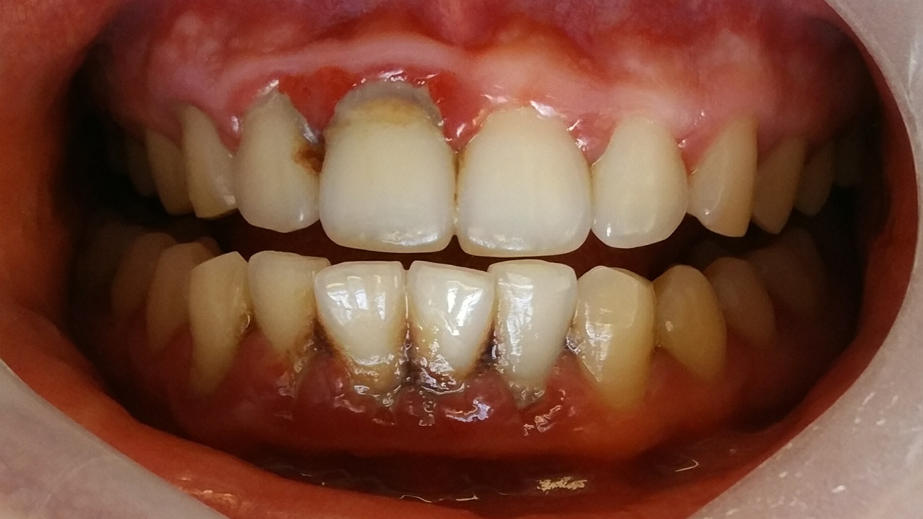 狗狗洗牙的良心忠告,医生忠告千万别洗牙