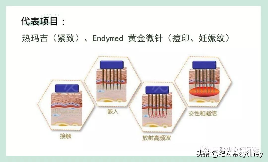 热玛吉超声刀光子嫩肤,超声炮热玛吉光子嫩肤的区别