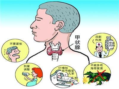 甲亢治疗反复该怎么办,甲亢复发要吃药多久才能好