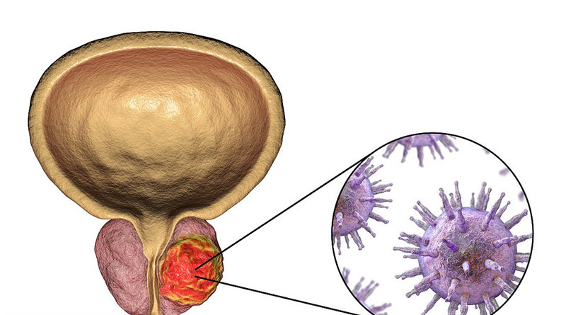 癌标志物七项检查能筛查哪些癌症,癌症要怎么去治疗
