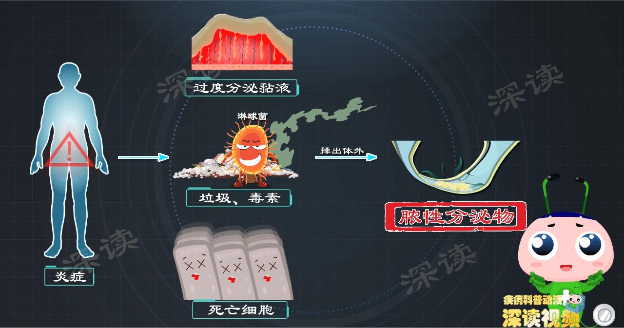 女性如何知晓得了淋病,女的有淋病一次就能中招吗