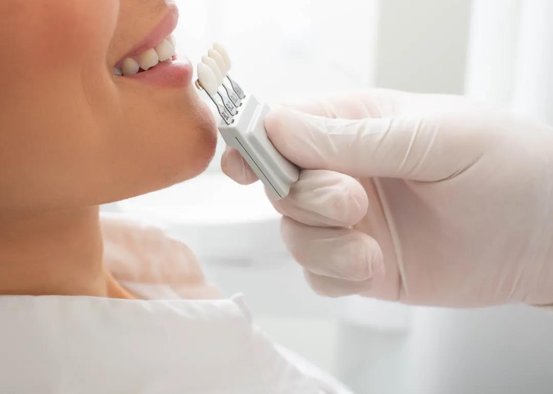 牙膏蘸白醋刷可以使牙齿变白吗,贴美白牙贴是如何让牙齿保持干燥