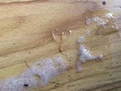 猫吐出的黄水里面有寄生虫,猫呕吐吐出虫子怎么办