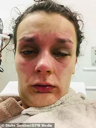 因为一时疏忽让自己悔恨终生,因为一时的疏忽造成了终身后悔