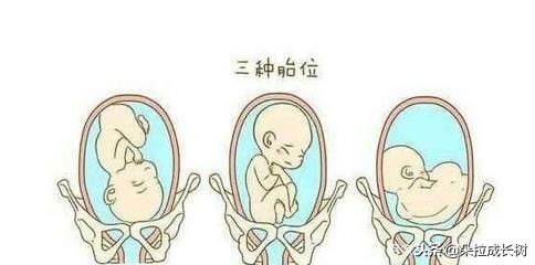 怀孕几周检查胎位正不正,怀孕几周胎位才会固定