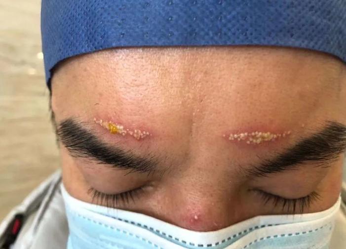 直击一线救护人员,银川市紧急救援中心院前医生