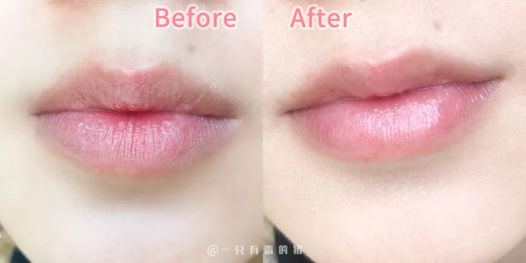 空管润唇膏,润唇膏空管