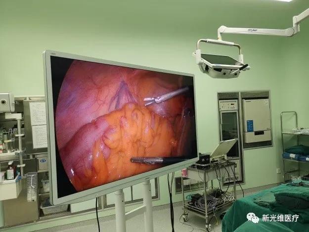 “维医护航新之所向”4K超高清腹腔镜手术直播会议顺利举行