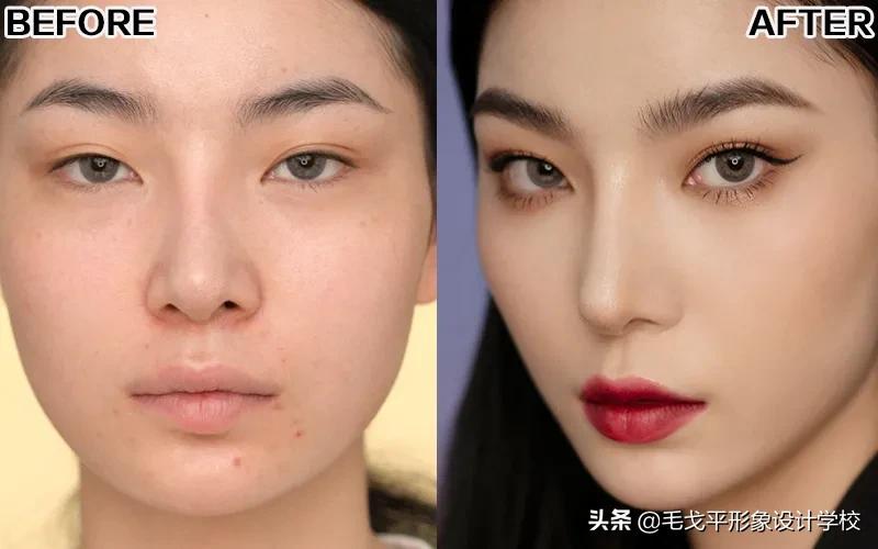 扁平的脸如何变立体微整,整骨脸变扁平怎么办