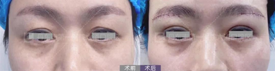 拥有一张好看的脸,如何拥有好看的脸型