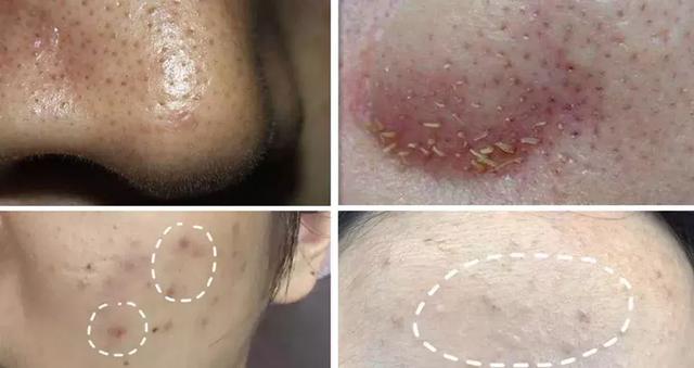 古力娜扎大额头妆容,古力娜扎万圣节