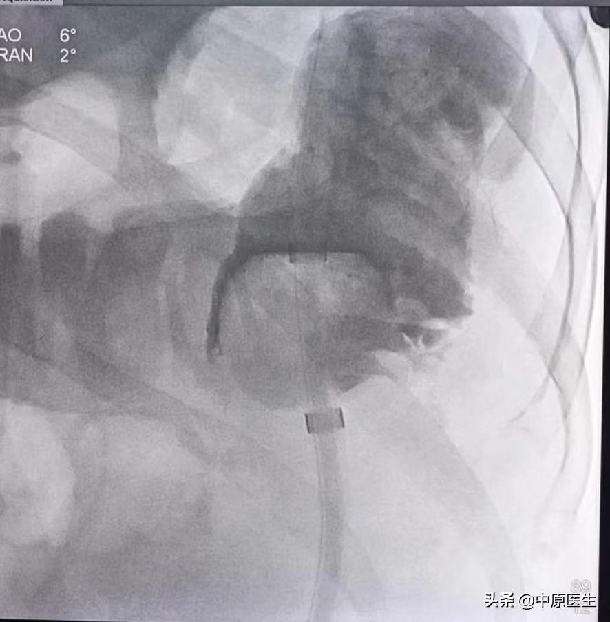 手术室没想象中的那么可怕,手术室没有想象的那么可怕