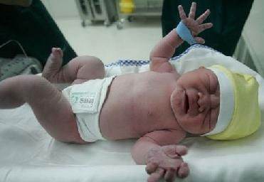 产科医生孕妇快生了,孕妇有这4种情况通常不建议顺产