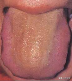 最实用的舌诊图六大舌象,舌诊深入学习书