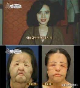 日本整容失败面目全非的10大女星,日本整容最成功的女星