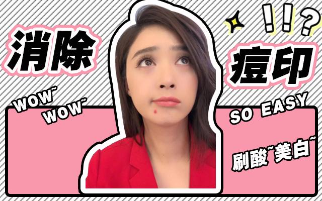 痘印严重到底怎么办,毁容式痘痘有什么办法消除