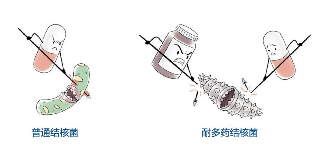 防治耐多药结核病要做好感染控制,2019年中国耐多药结核病治愈率