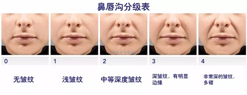 有眼袋黑眼圈法令纹怎么办,黑眼圈泪沟法令纹高光