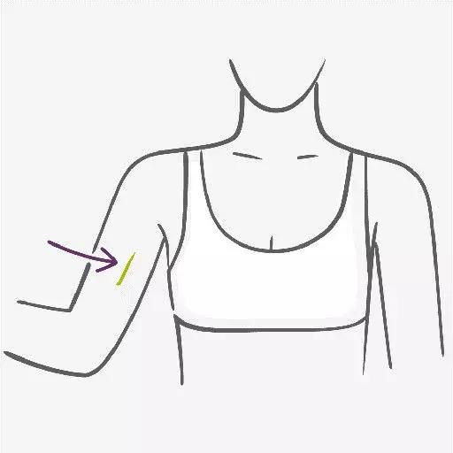 哺乳期妈妈纯孕激素疗法,哺乳期不避孕的条件